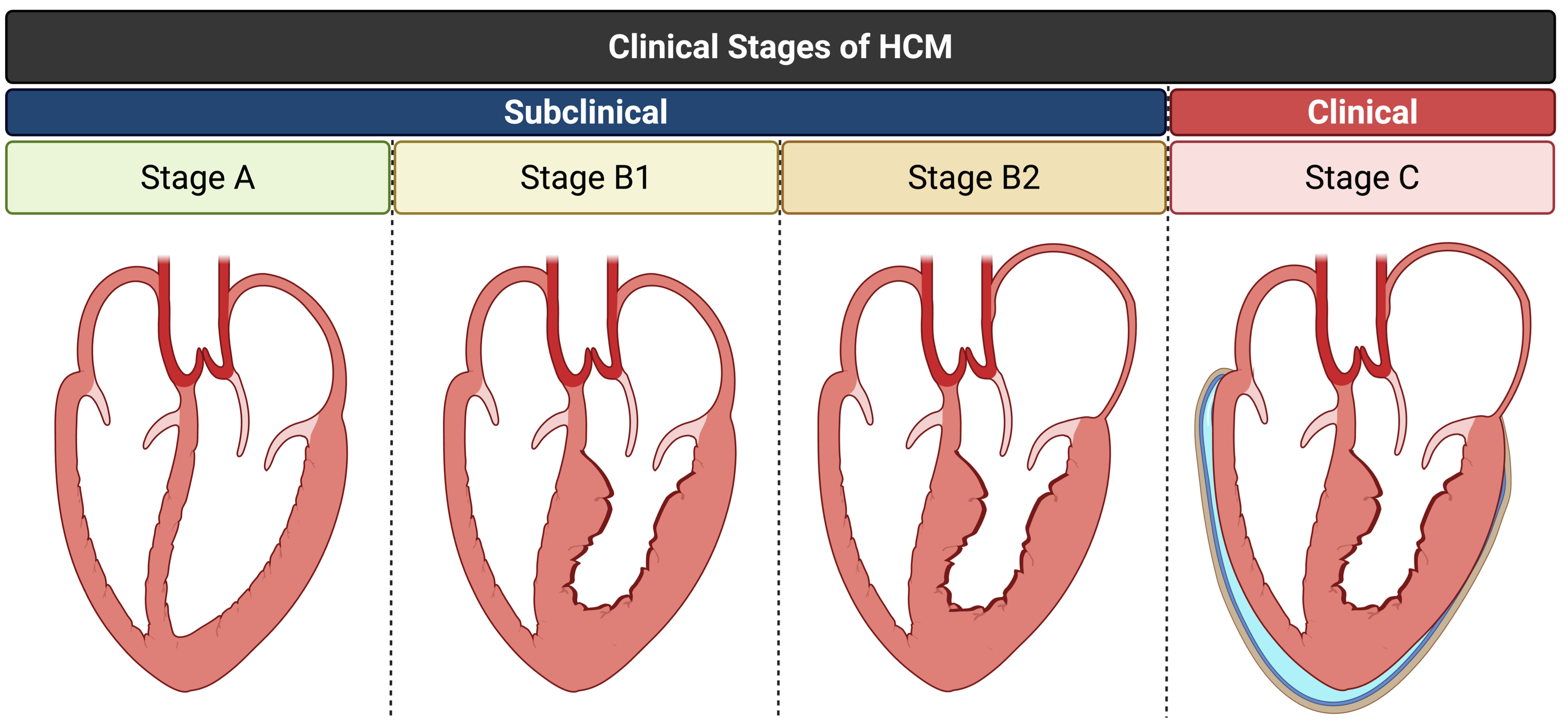 HCM.png